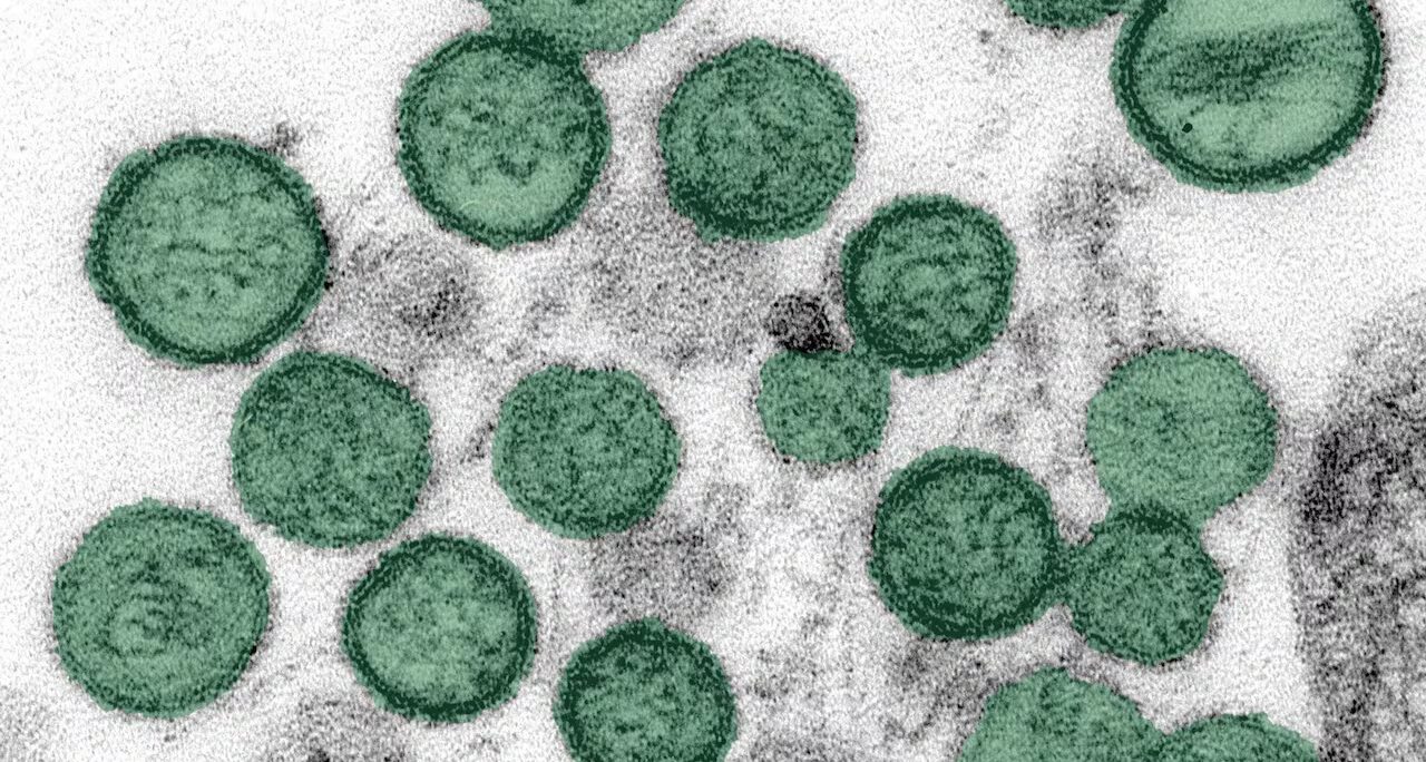 Hantavirus: Das Schiff des Todes – Dark Science Lab