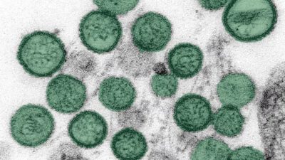 Hantavirus: Das Schiff des Todes – Dark Science Lab