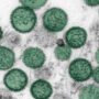 Hantavirus: Das Schiff des Todes – Dark Science Lab