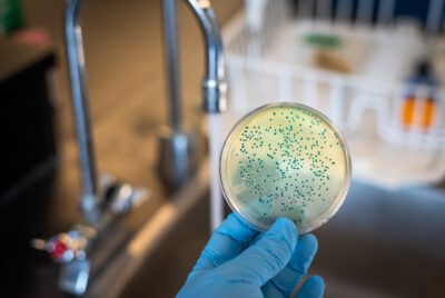 Berliner Seen speichern Resistenz-DNA – und das Risiko wächst im Schlamm